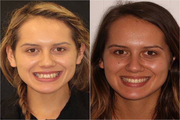 glenview dental treatment